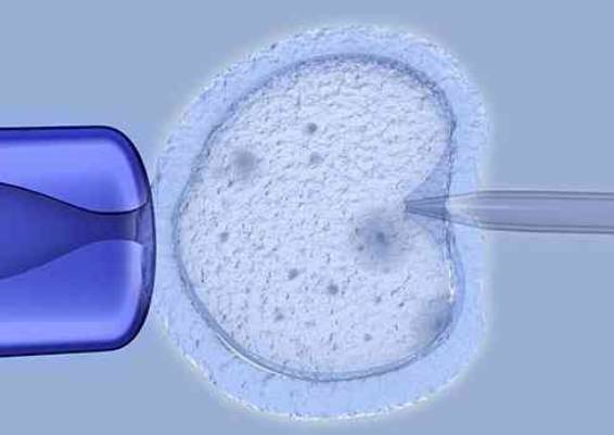 女性备孕前也需要做检查，生殖内分泌检查一定要做_1
