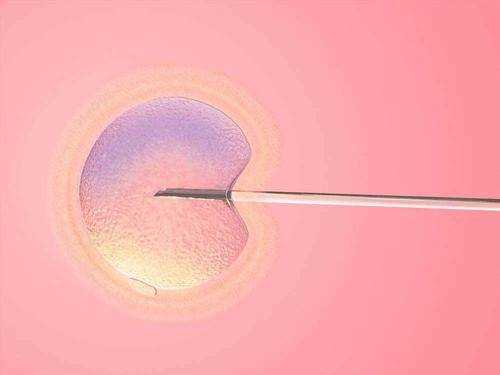 孕期前置胎盘的危险性提前了解，附预防前置胎盘的措施