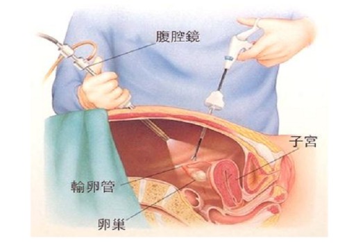 上海试管助孕价格：怀孕期间肚皮痒有红点怎么回事，了解母婴健康及时做好预防
